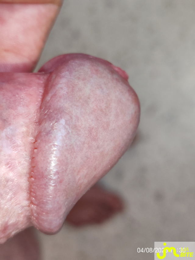 bites de Titi94