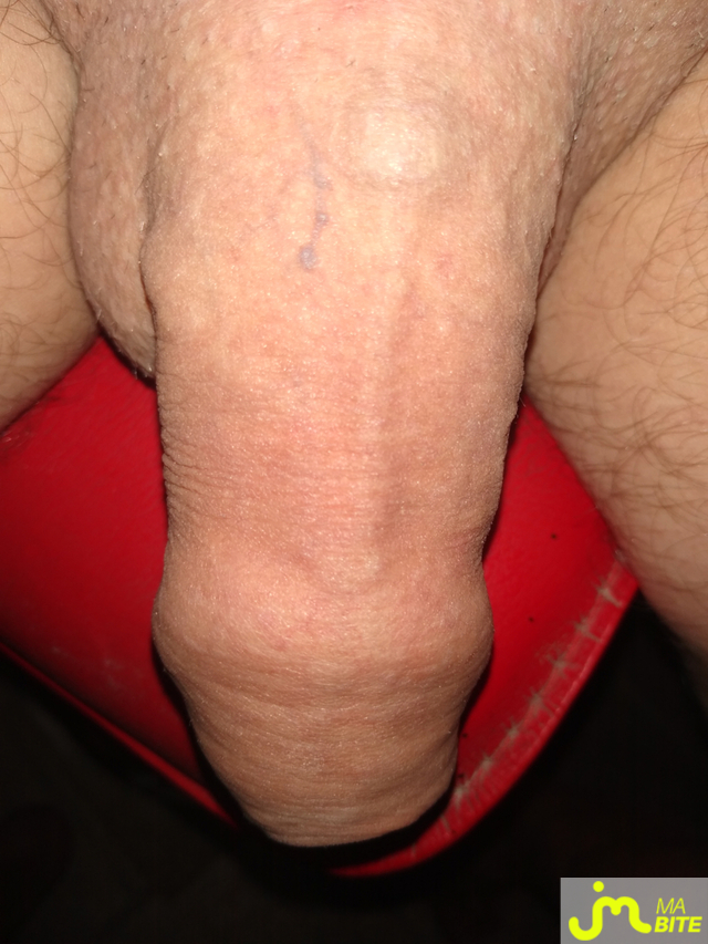 bites de Lami63