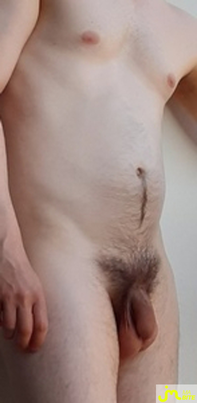bites de M4tthieu