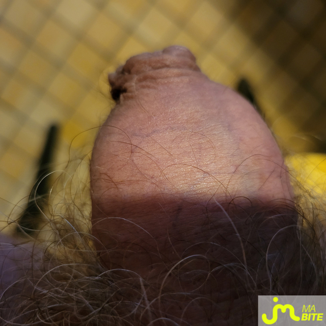 bites de Gland perlé