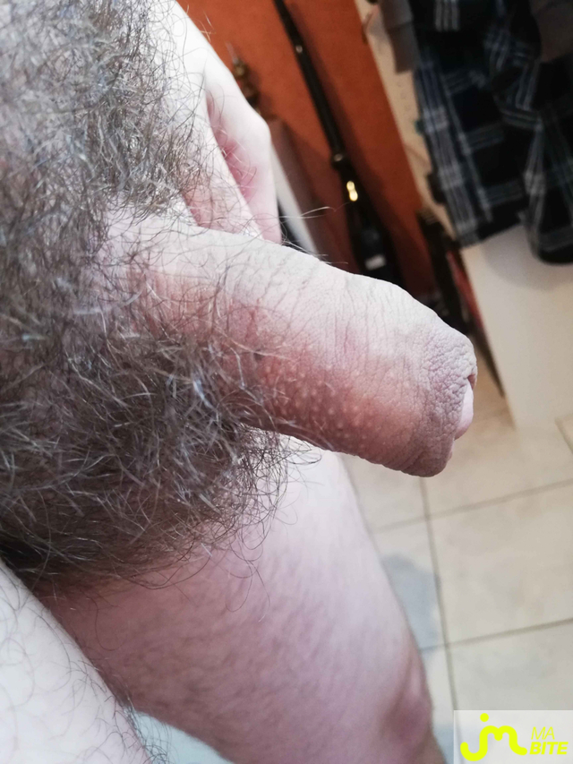 bites de Nivek285