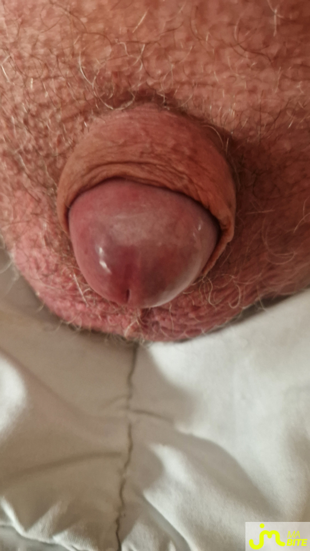 bites de micro76
