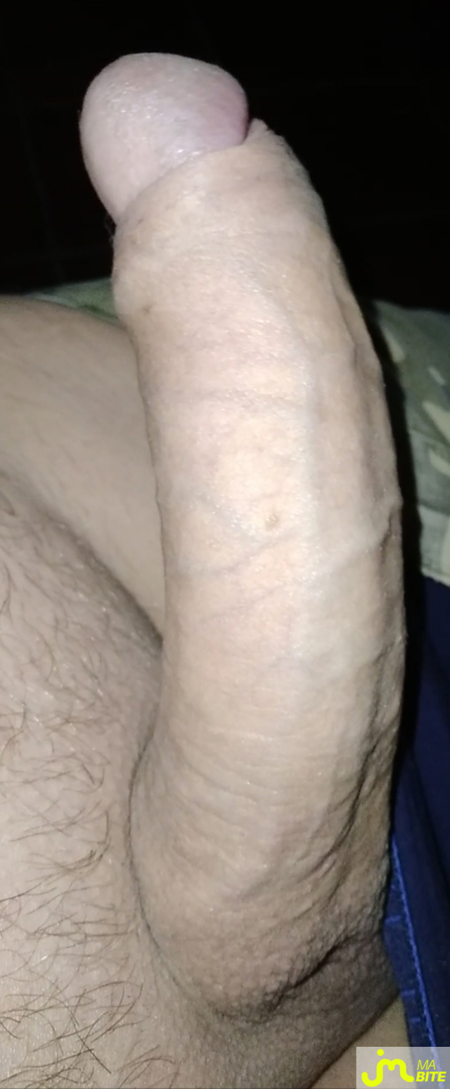 bites de stalx
