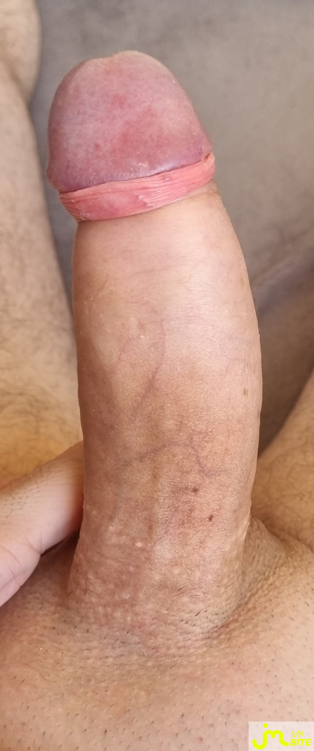 bites de coquindu766
