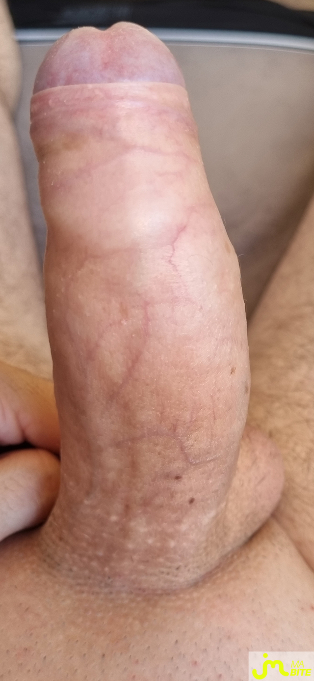 bites de coquindu766
