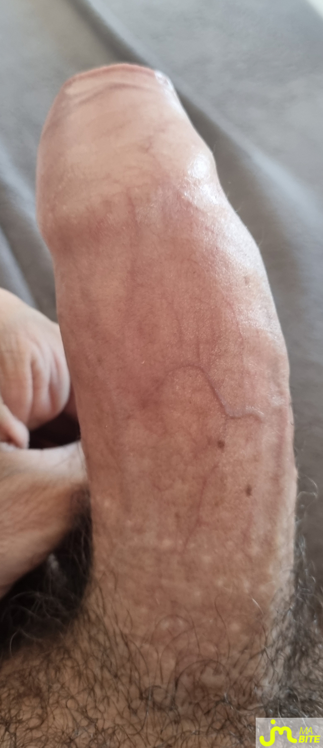 bites de coquindu766