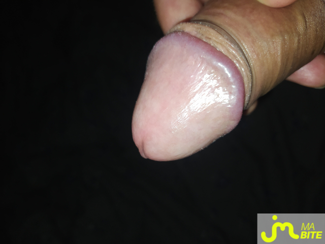 bites de redograp