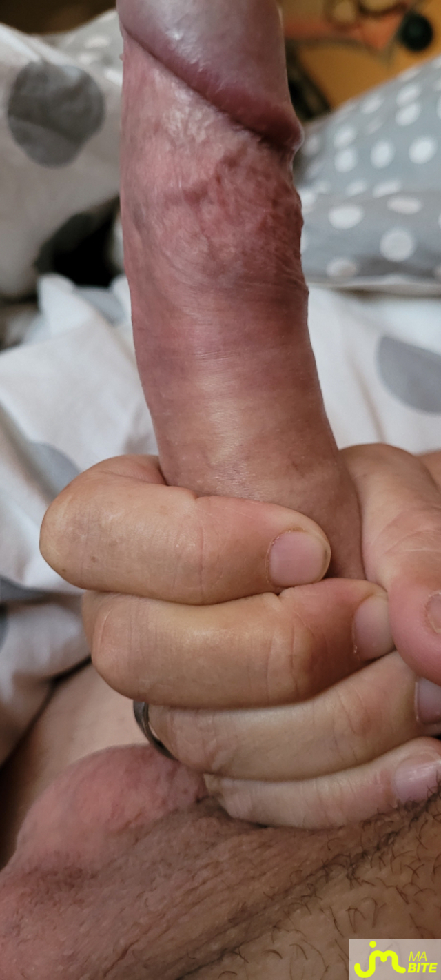 bites de loulousex95