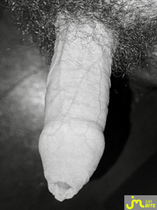 bites de Couplebibaiseurs