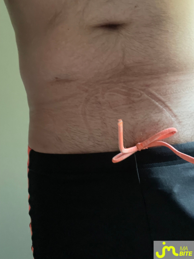 bites de yobzh