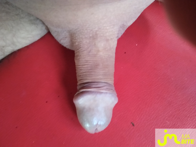 bites de Lami63