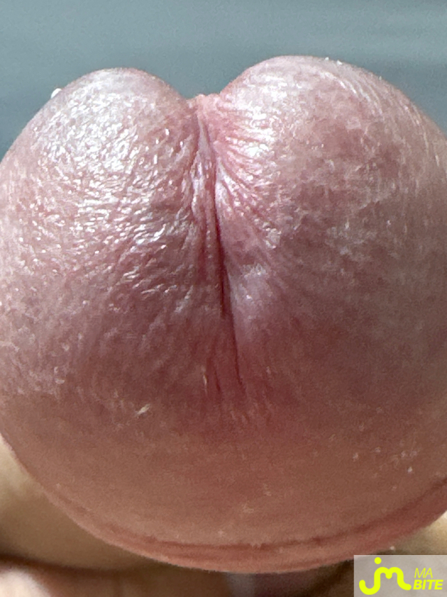bites de Elantho