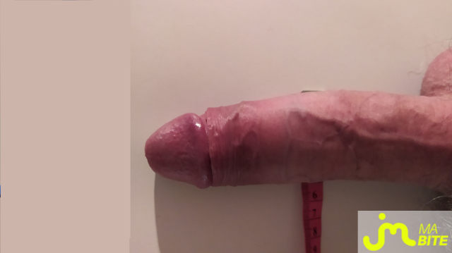 bites de 1918CM