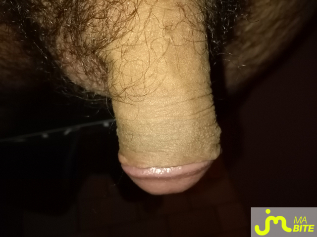 bites de Peggingman