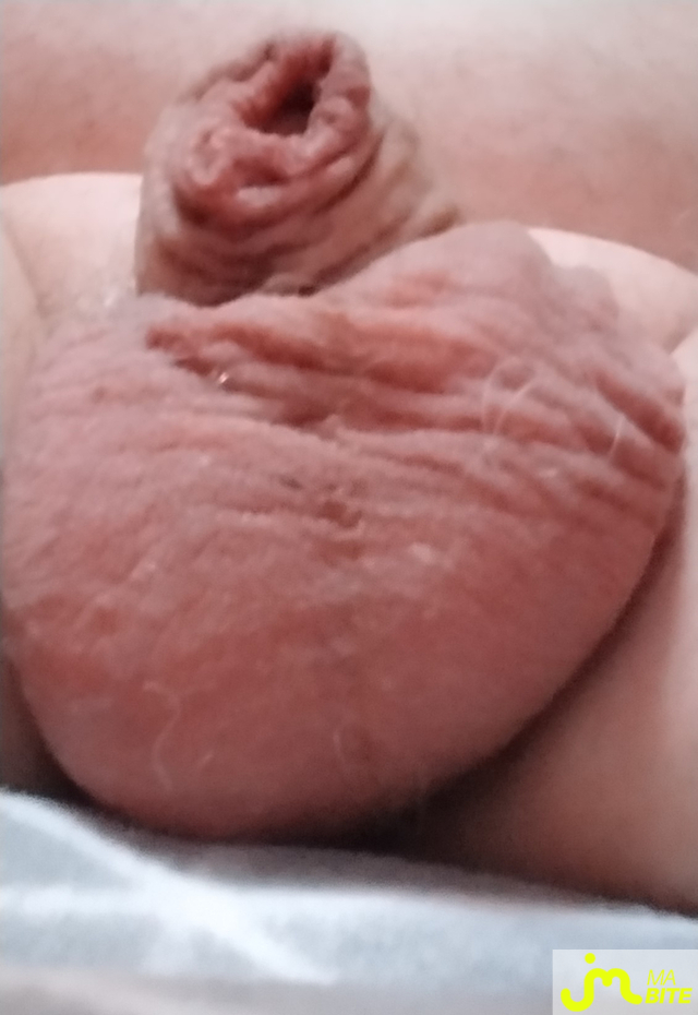 bites de jejenot