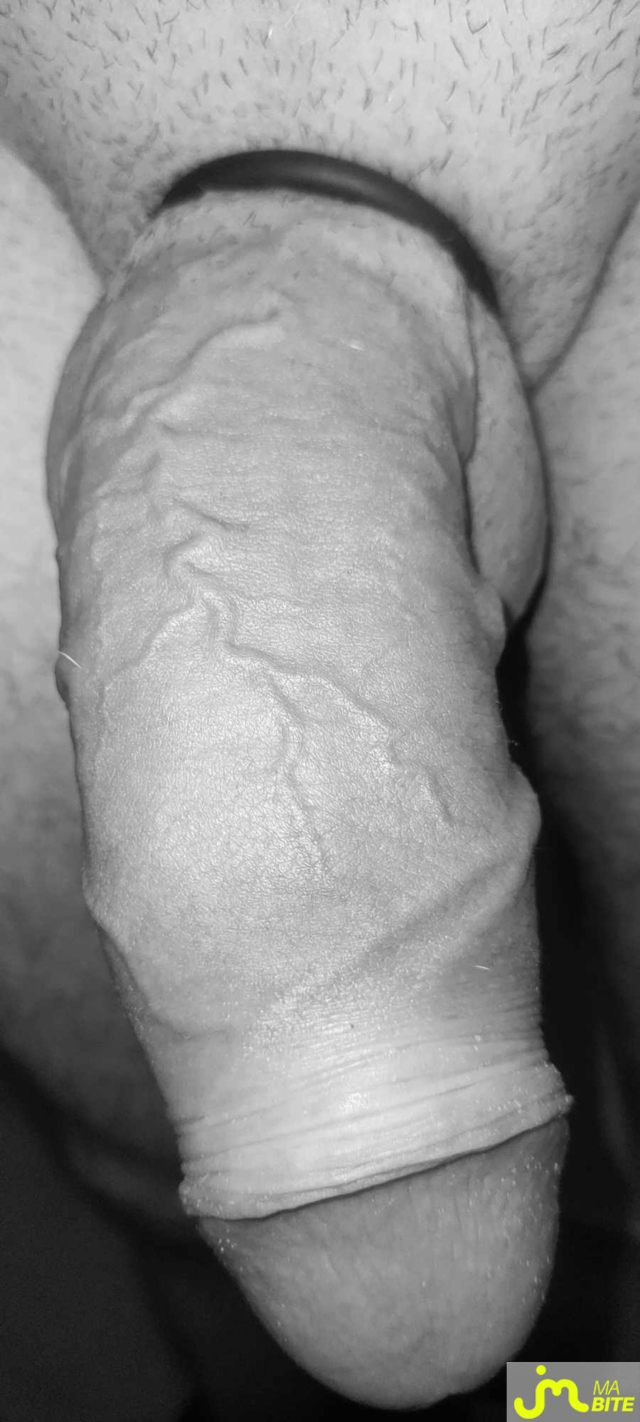 bites de Franck44
