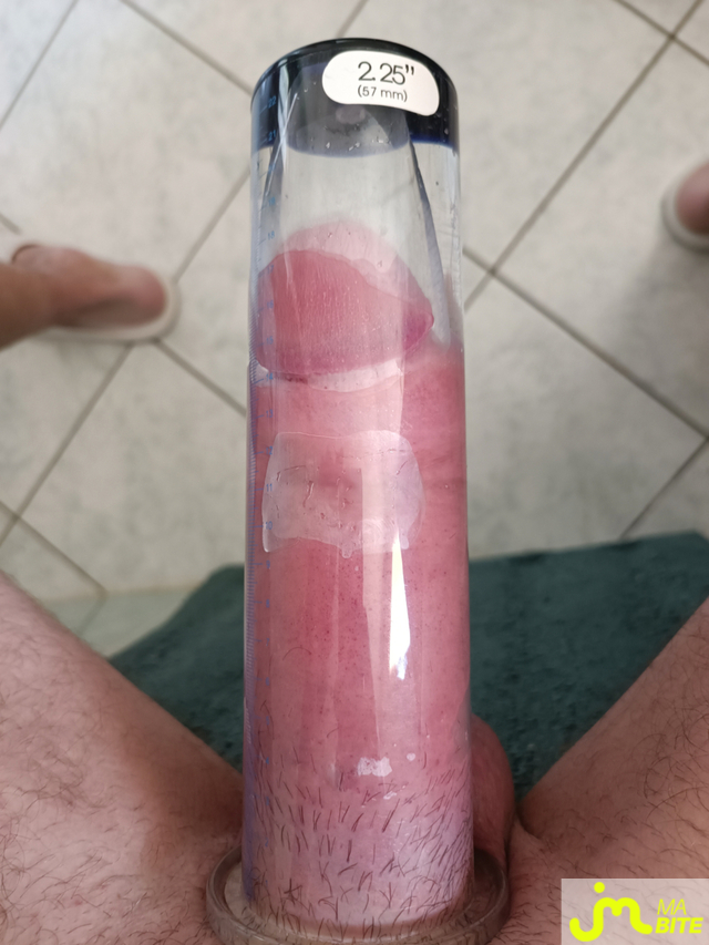 bites de Cpl8793