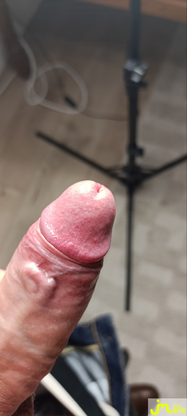 bites de Martoni