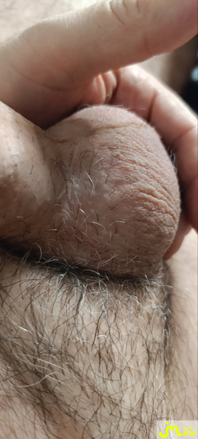 bites de Martoni