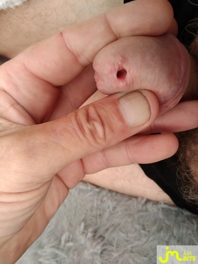 bites de Le brestoas