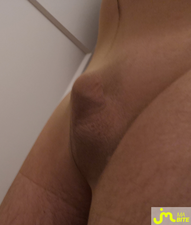 bites de Mercier67