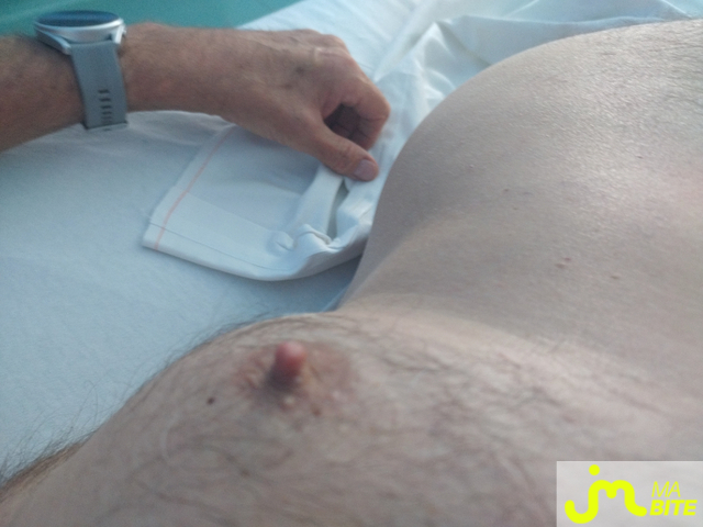 bites de thieus34