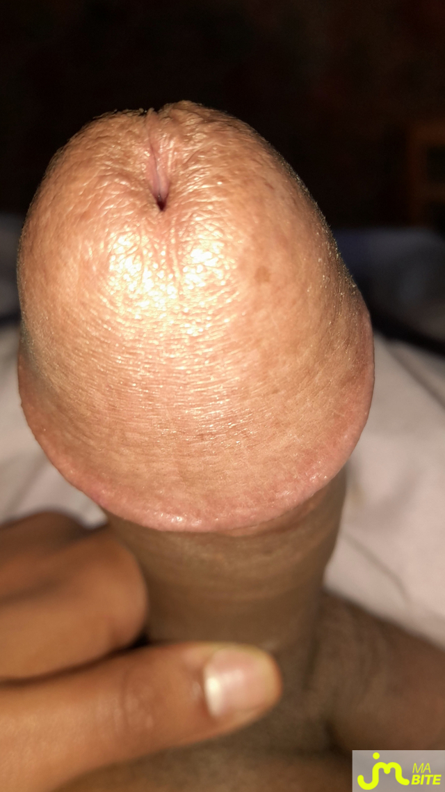 bites de Éricoupe75