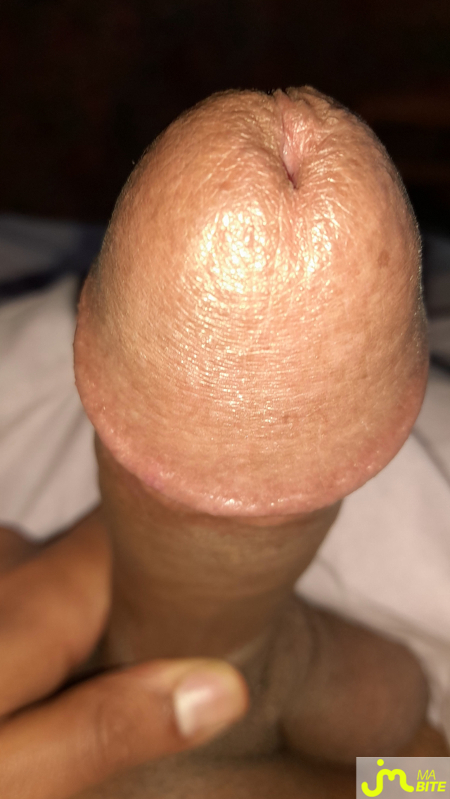 bites de Éricoupe75