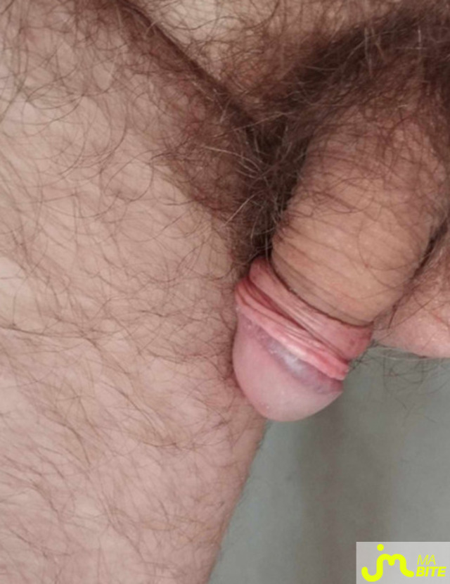 bites de nordyves