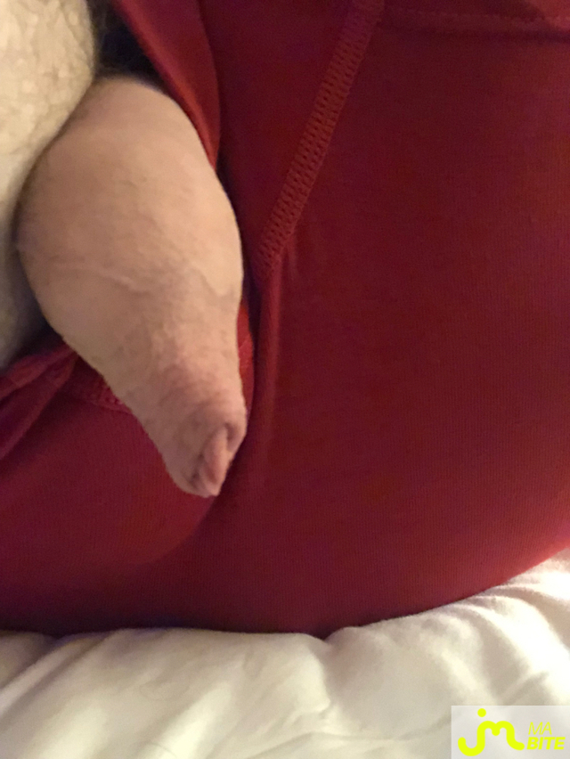 bites de longprepuce