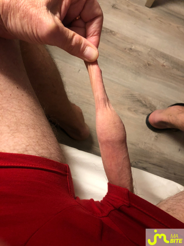 bites de longprepuce