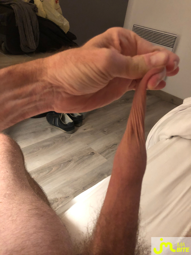 bites de longprepuce