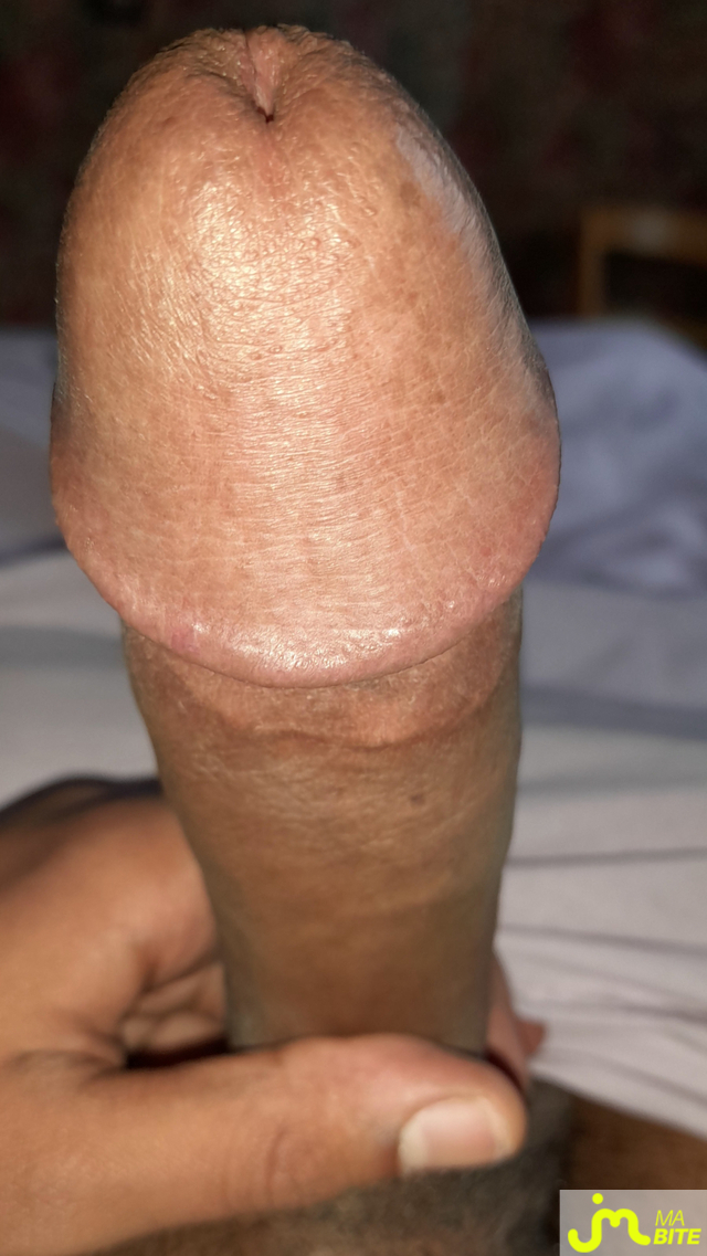 bites de Éricoupe75