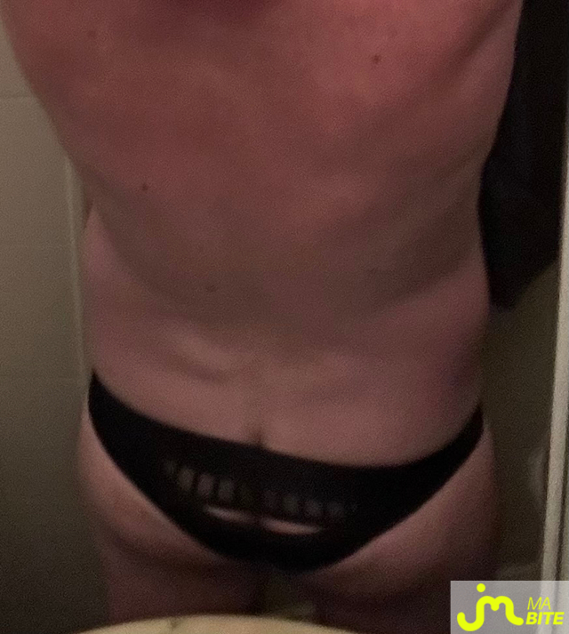 bites de Stephp81