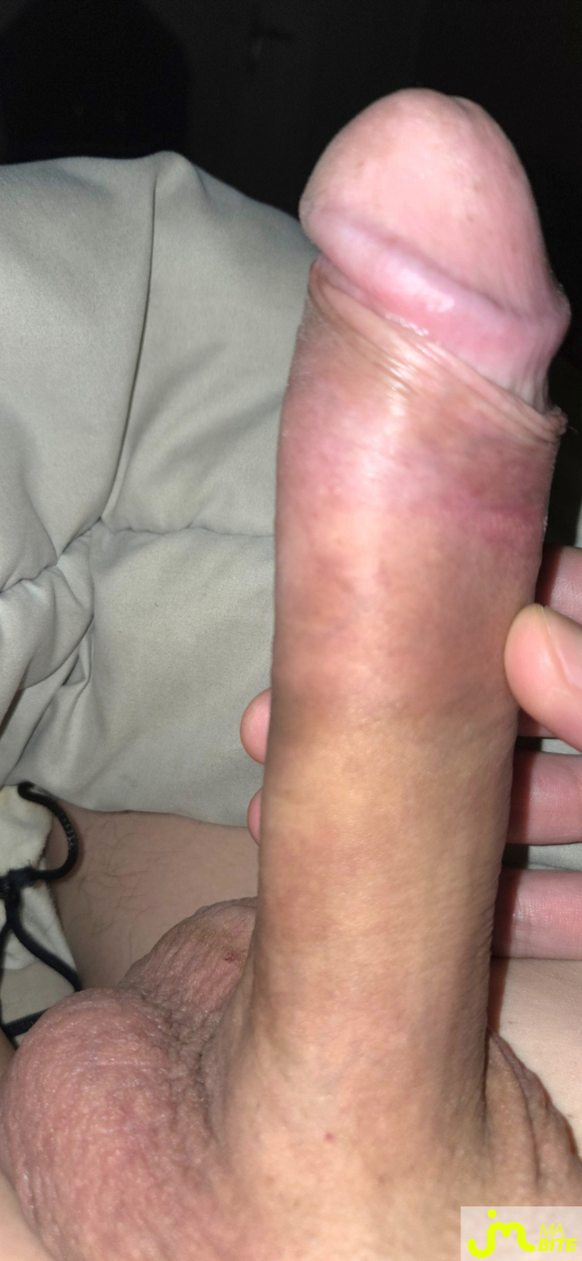 bites de Calvin02000