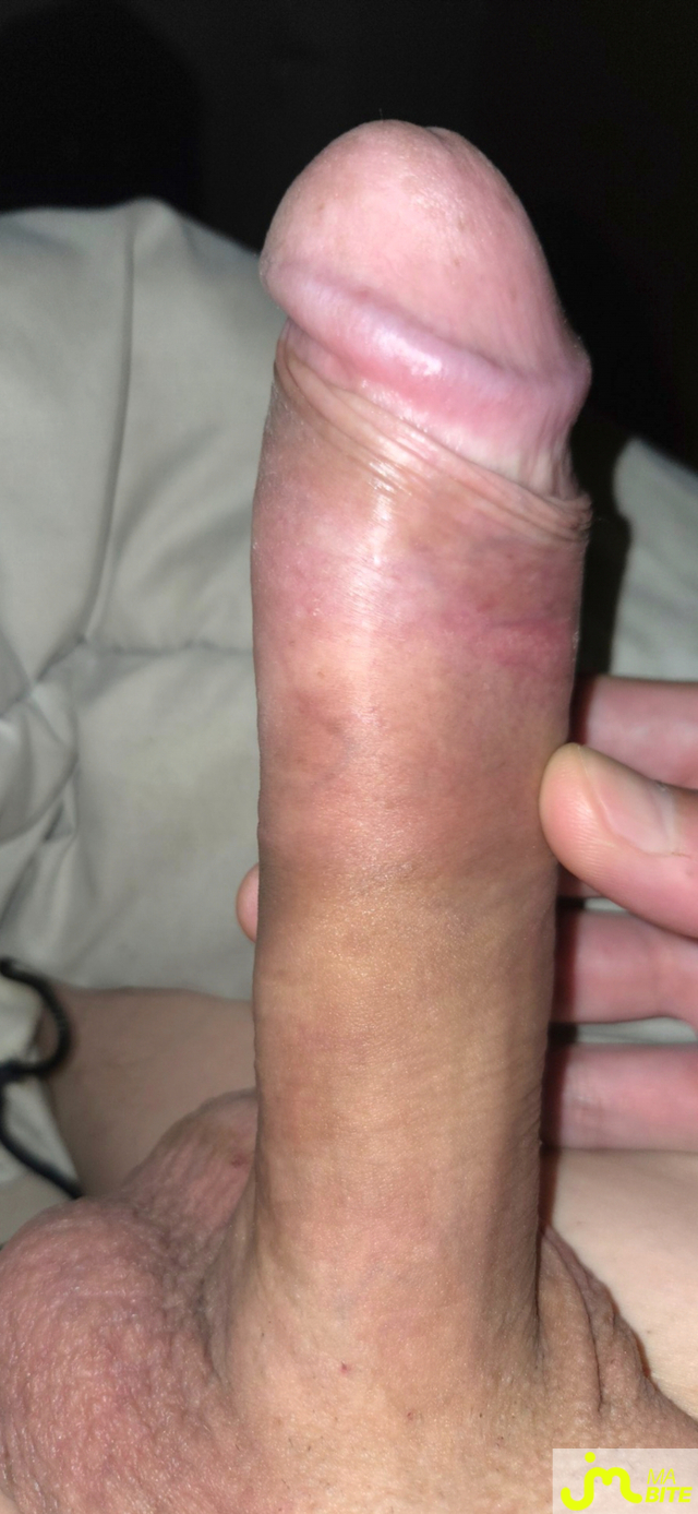 bites de Calvin02000