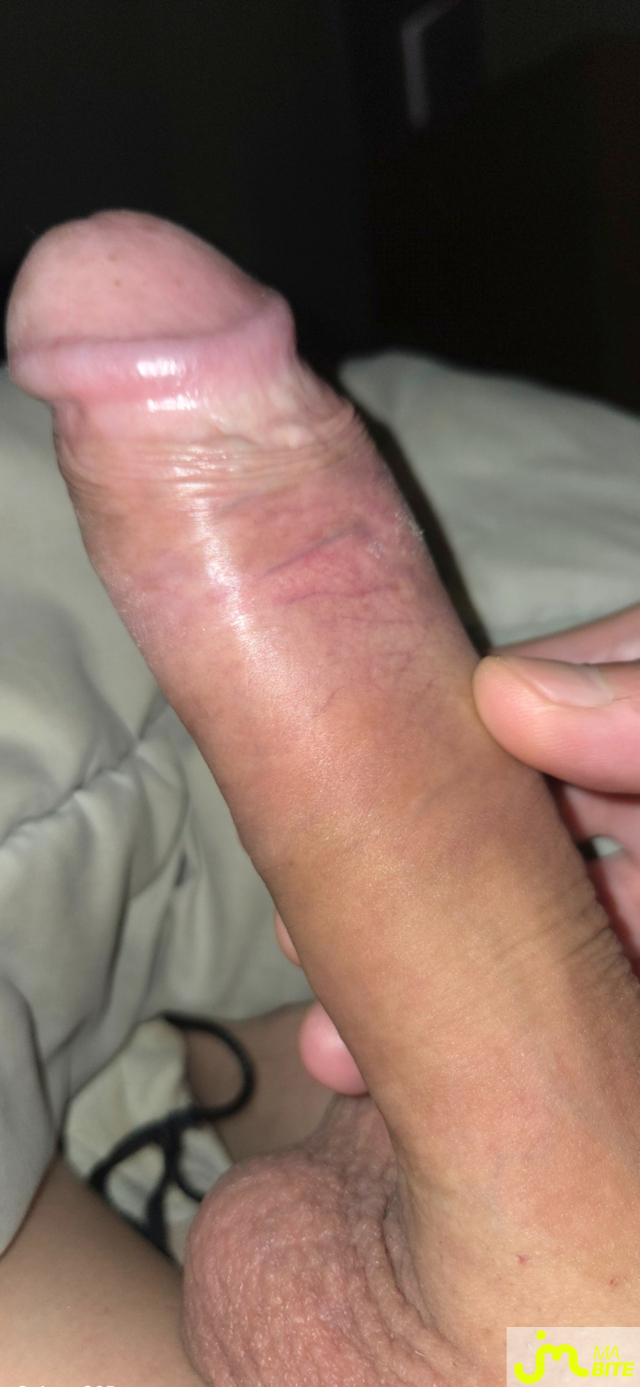 bites de Calvin02000