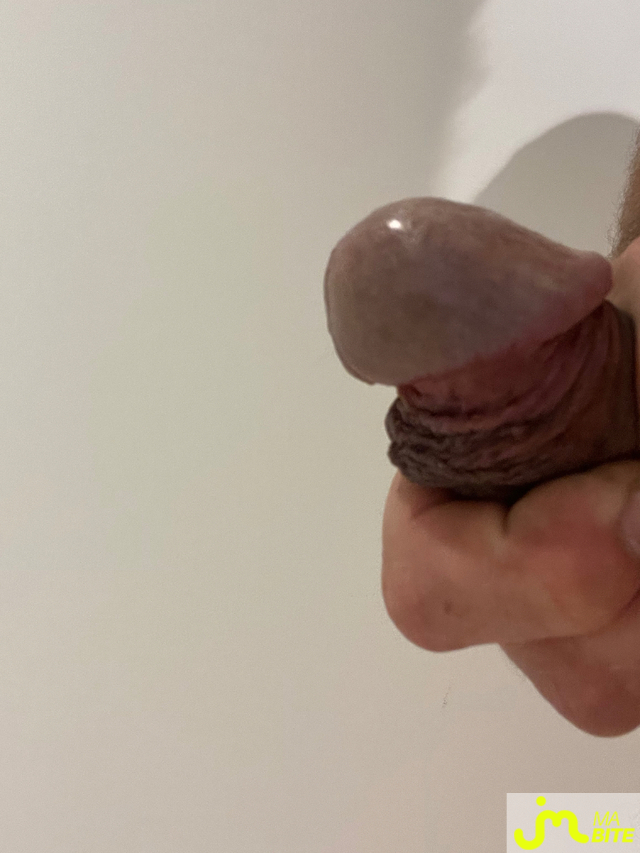 bites de Raou