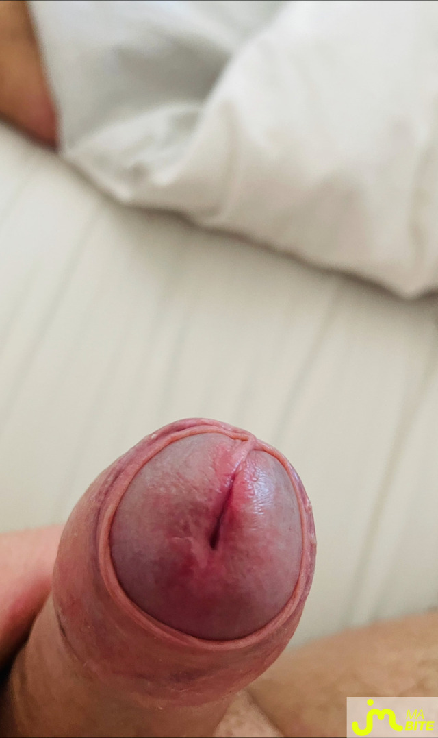 bites de Lanchebre
