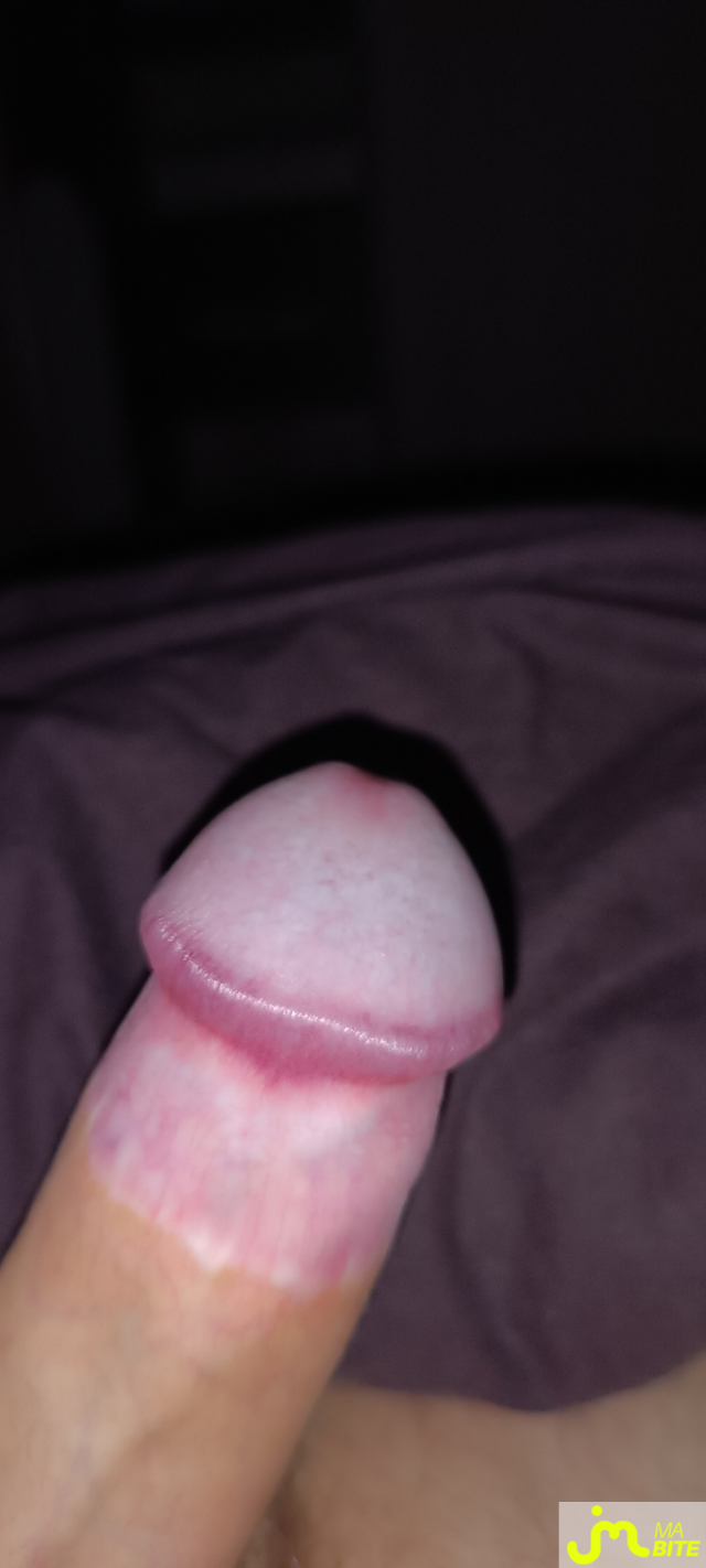 bites de Dolby57