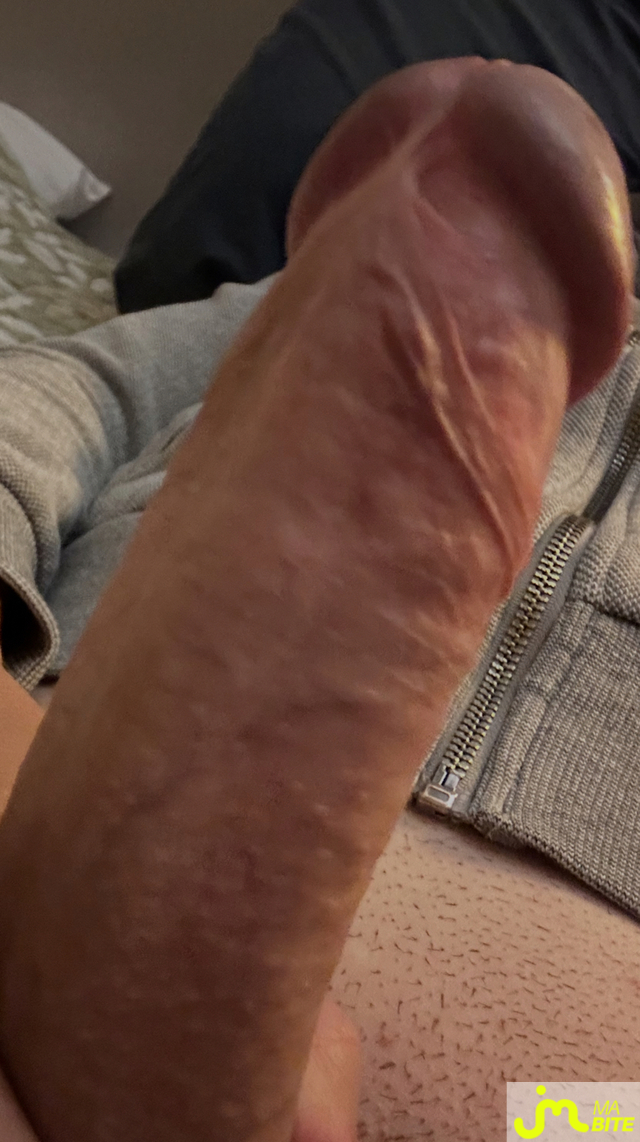 bites de Diday