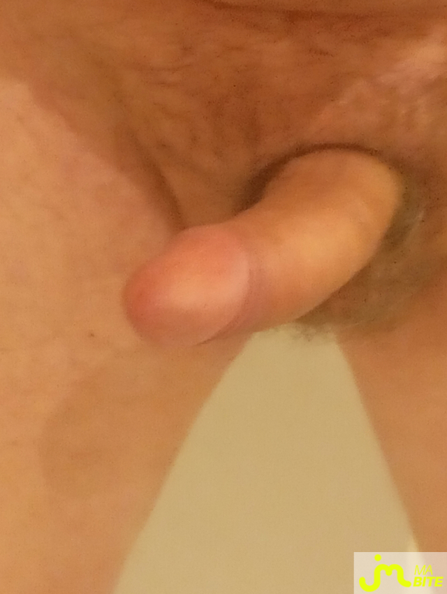 bites de PAT22
