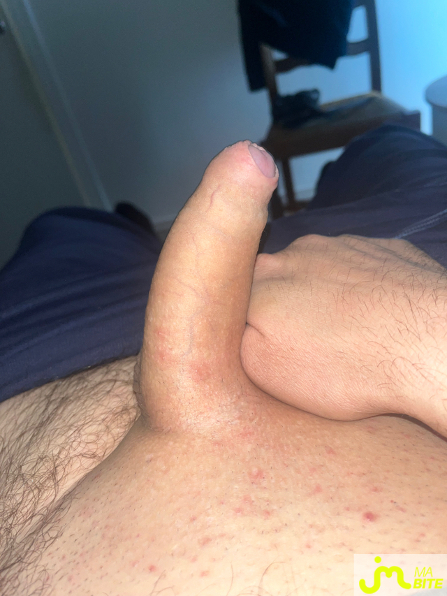 bites de Mecdu93220