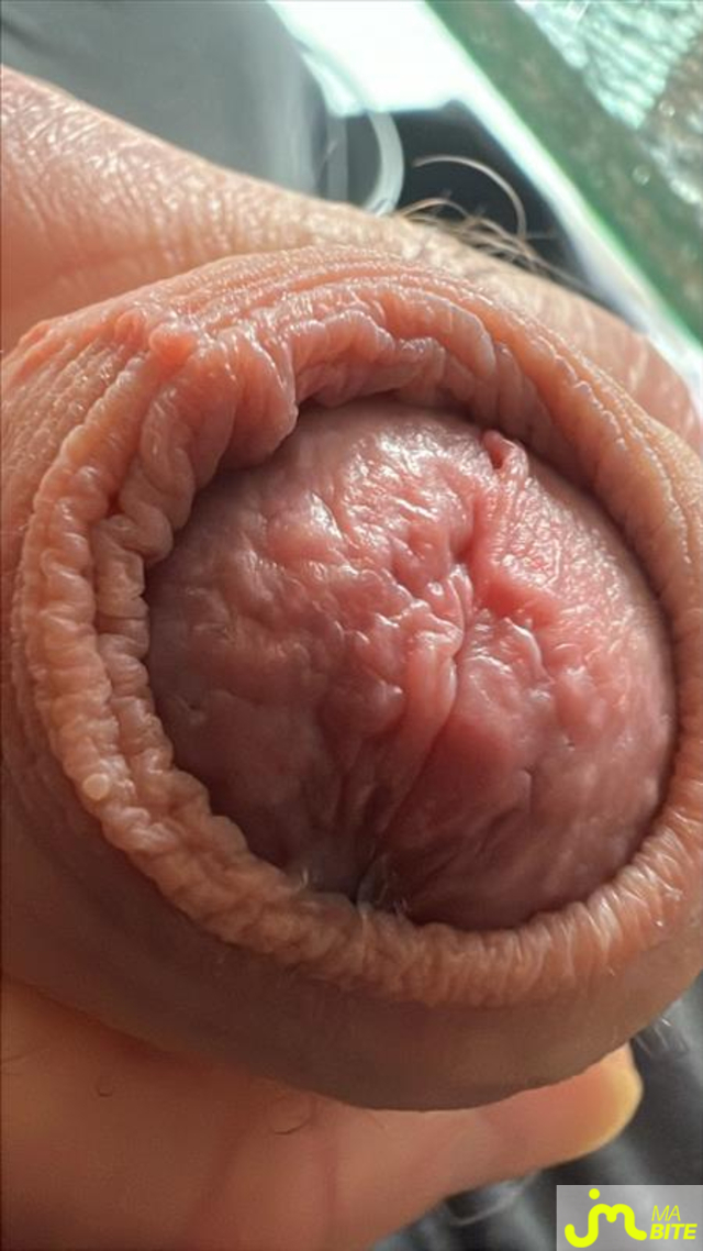 bites de close_up_zizi