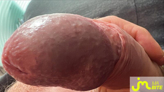 bites de close_up_zizi