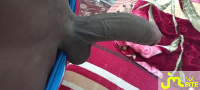 bites de Blackcock46