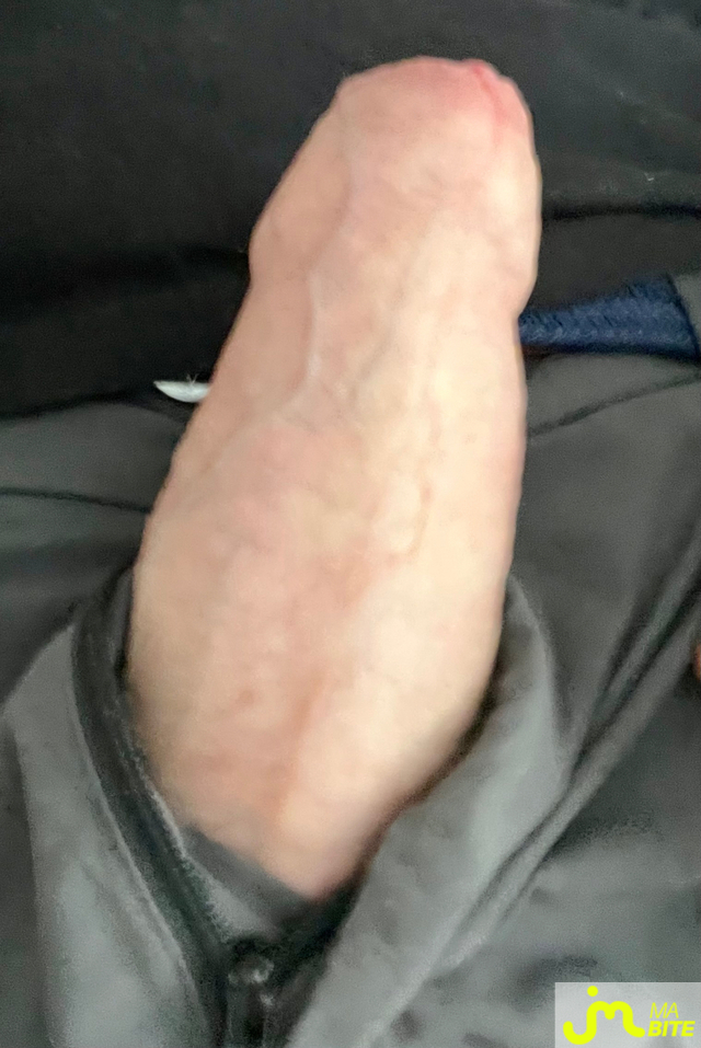 bites de clgb62