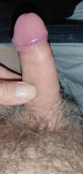 Photos de bites : BITES