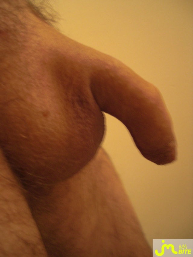 bites de bebe