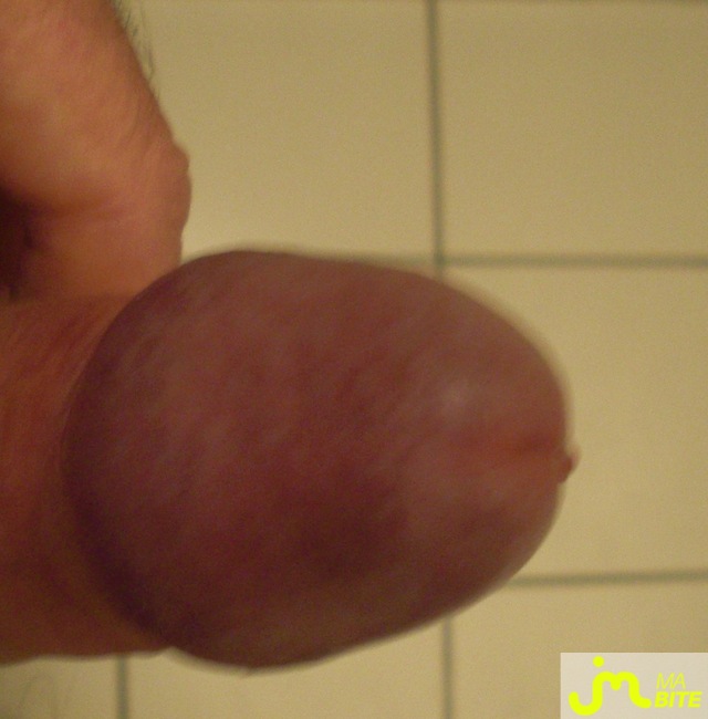 bites de bebe